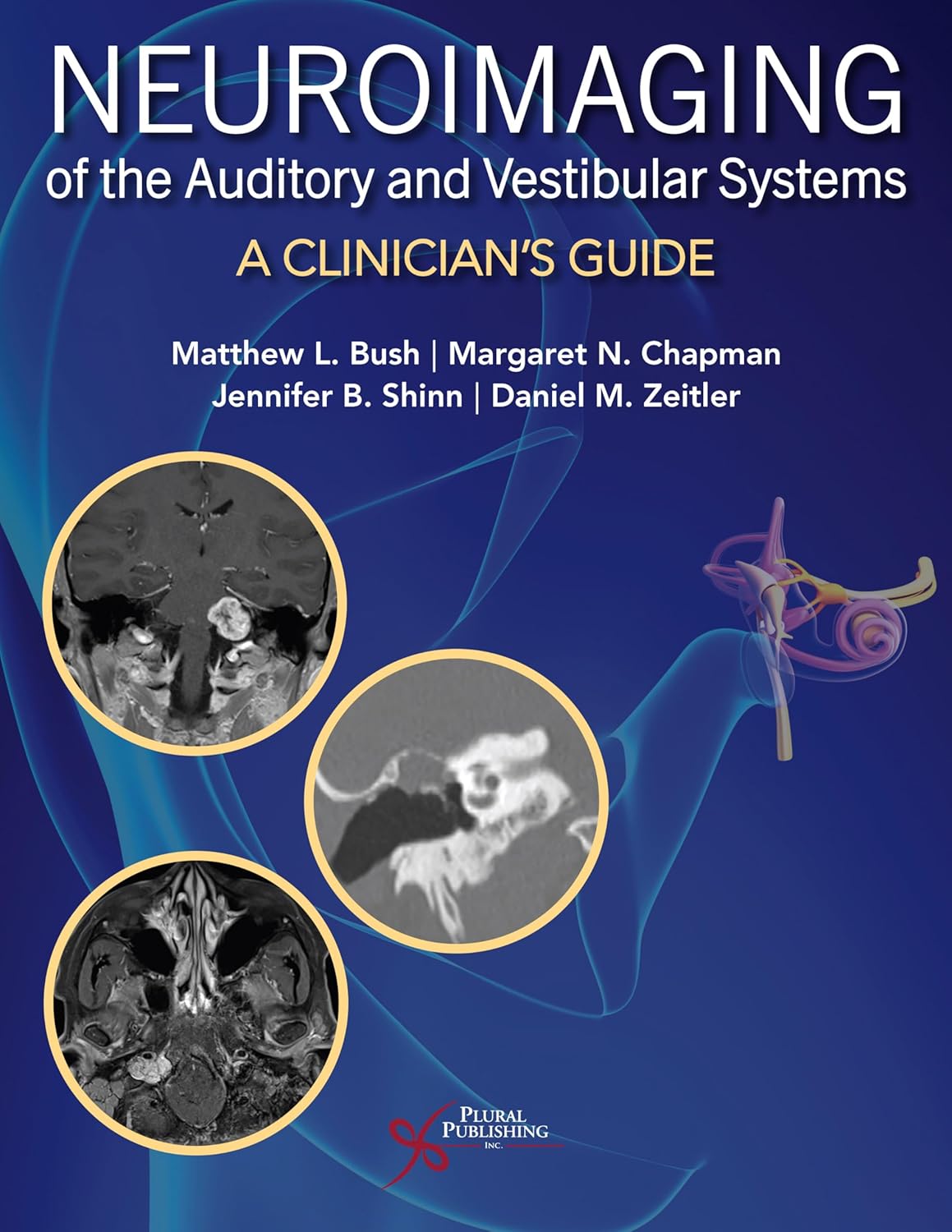 Neuroimaging of the Auditory and Vestibular Systems: A Clinician’s Guide