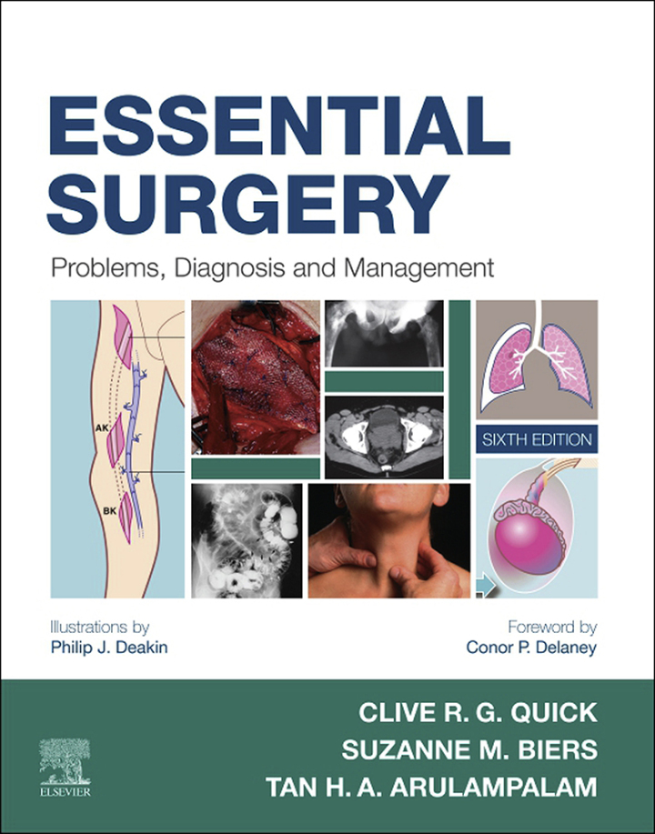 Essential Surgery: Problems, Diagnosis and Management 6th Edition